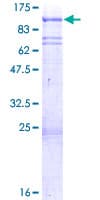 Human SNK / PLK2 Protein (Recombinant GST)