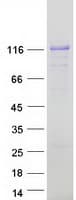 Human AFAP1L1 Protein (Recombinant Myc-DDK (Flag))