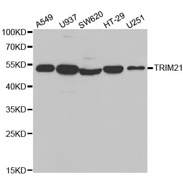 TRIM21 / RO52 Antibody
