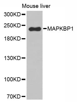 Polyclonal Rabbit anti-Human MAPKBP1 Antibody (IHC, WB)