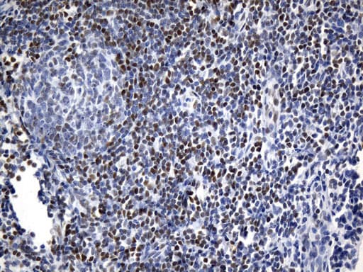 FOXP1 Antibody (clone UMAB242, Carrier-free)