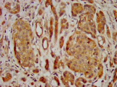 FREM2 Antibody