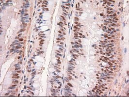 MYC / c-Myc Antibody (clone OTI3F2)