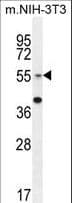IHC-plus™ GCNT3 Antibody (aa390-418)