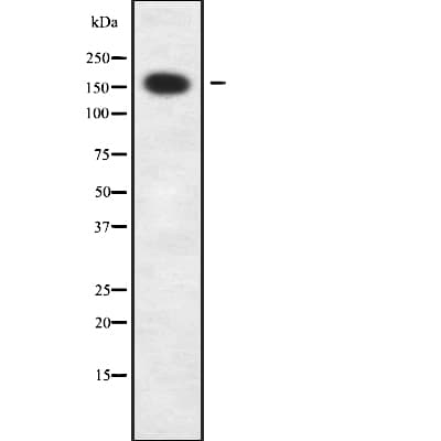 Polyclonal Rabbit anti-Human Capicua / CIC Antibody (WB)