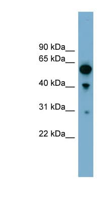Polyclonal Rabbit anti-Human ARHGAP15 Antibody (aa251-300, WB)