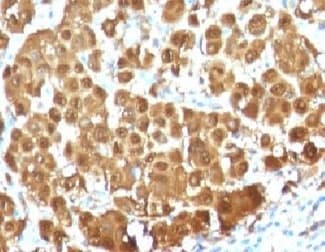S100B / S100 Beta Antibody (clone S100B/1012, Ready-to-Use)