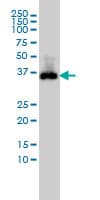 PathPlus™ CDX2 Antibody (clone 1C7)