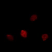 MKI67 / Ki67 Antibody
