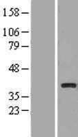 SLC25A27 / UCP4 Protein (Over-Expression Lysate Myc-DDK (Flag))