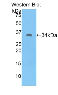 MT1E Antibody (aa1-61)