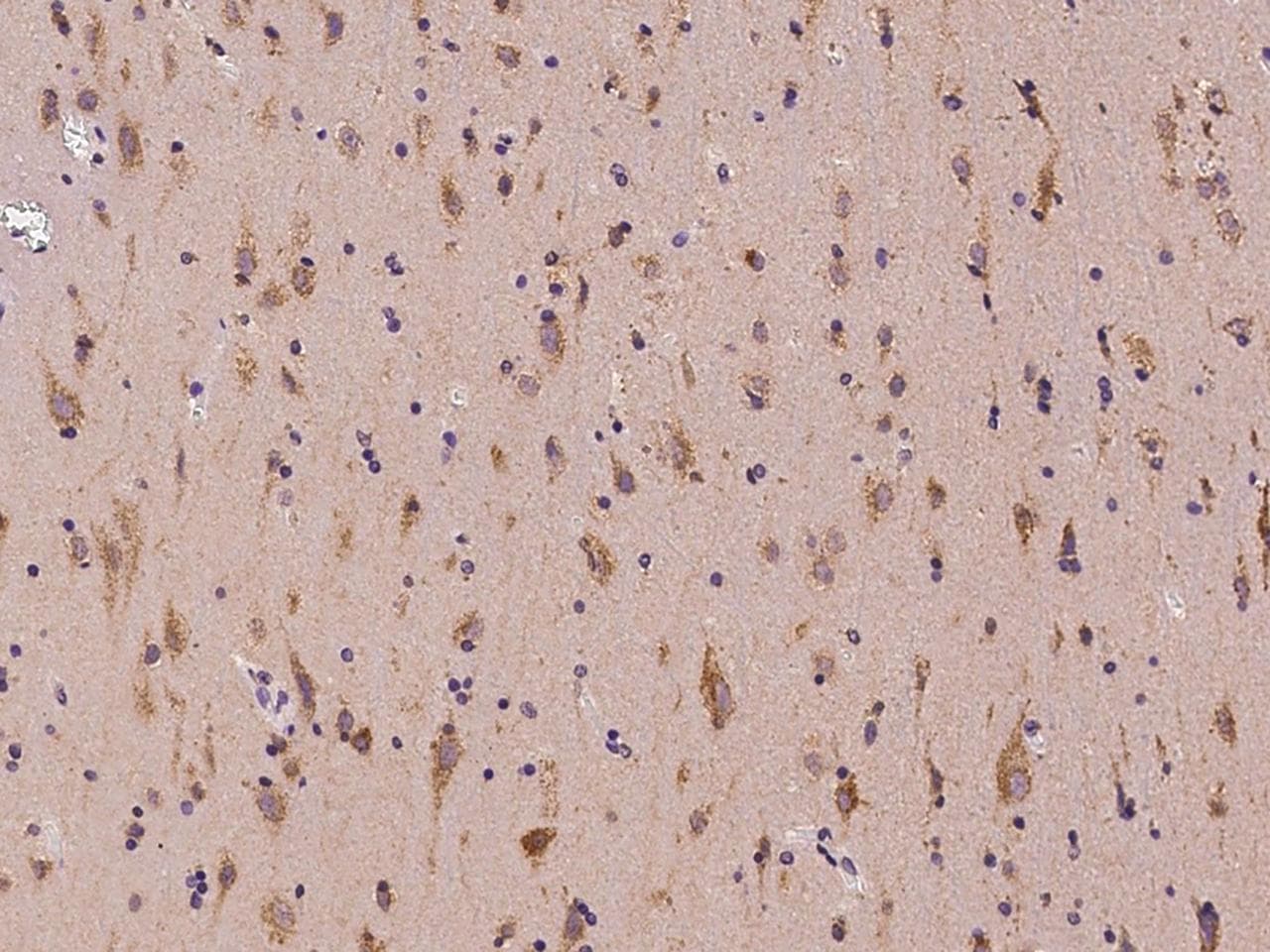 PIAS3 Antibody