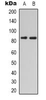 HGF / Hepatocyte Growth Factor Antibody (Internal)