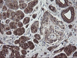 DPH2 Antibody (clone OTI2B12)