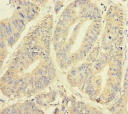 Polyclonal Rabbit anti-Human YME1L1 Antibody (IHC, WB)