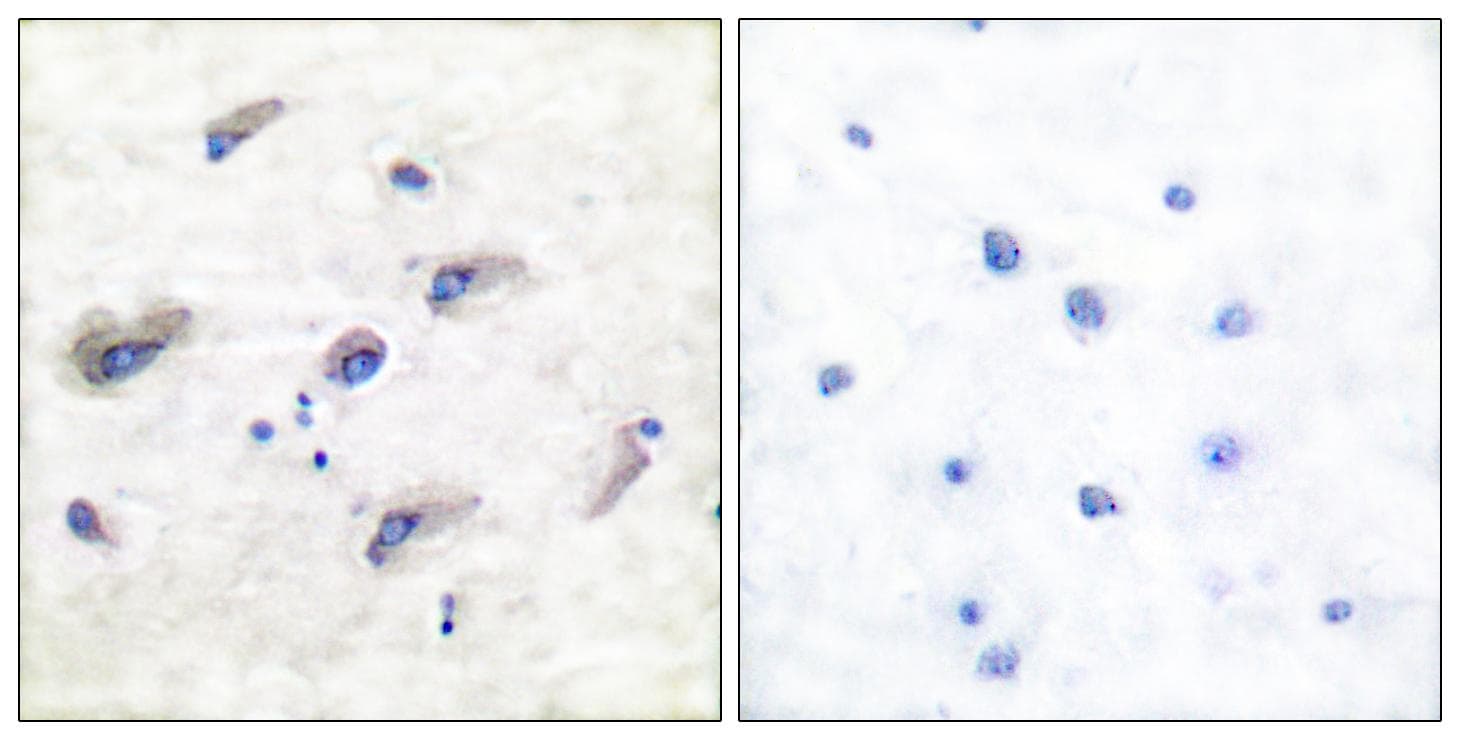 Polyclonal Rabbit anti-Human MAPT / Tau Antibody (phospho-Ser356, IHC, WB)