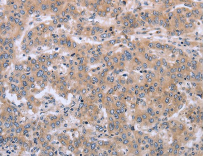 MAPRE3 / EB3 Antibody