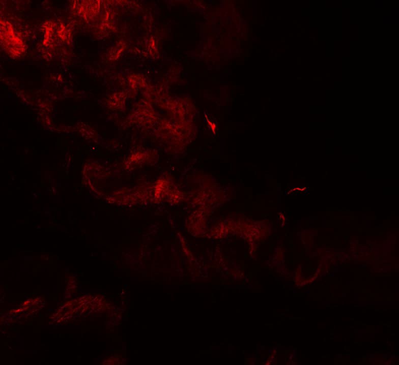 IHC-plus™ GOLGA1 / Golgin-97 Antibody