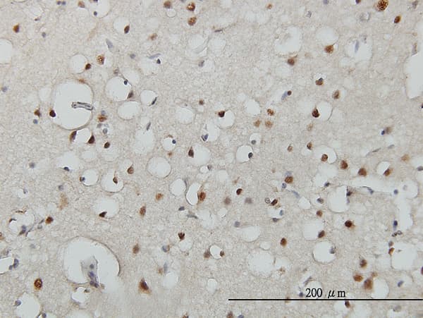 Monoclonal Mouse anti-Human USF2 Antibody (clone 5E9, IHC, IF, WB)