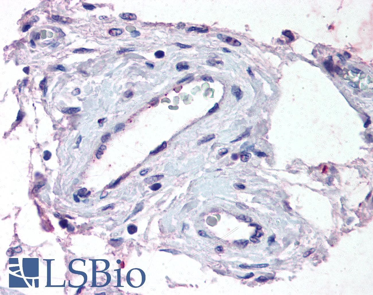 IHC-plus™ ADAMTS1 Antibody (Internal)