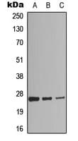 Polyclonal Rabbit anti-Human RAP2C Antibody (Internal, WB)