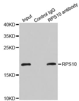 RPS10 / Ribosomal Protein S10 Antibody