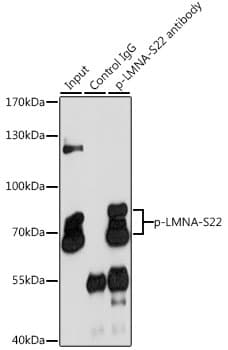 LMNA / Lamin A+C Antibody (phospho-Ser22)