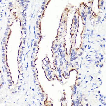 CD44 Antibody