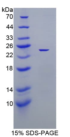Mouse XDH / Xanthine Oxidase Protein (Recombinant His-T7)