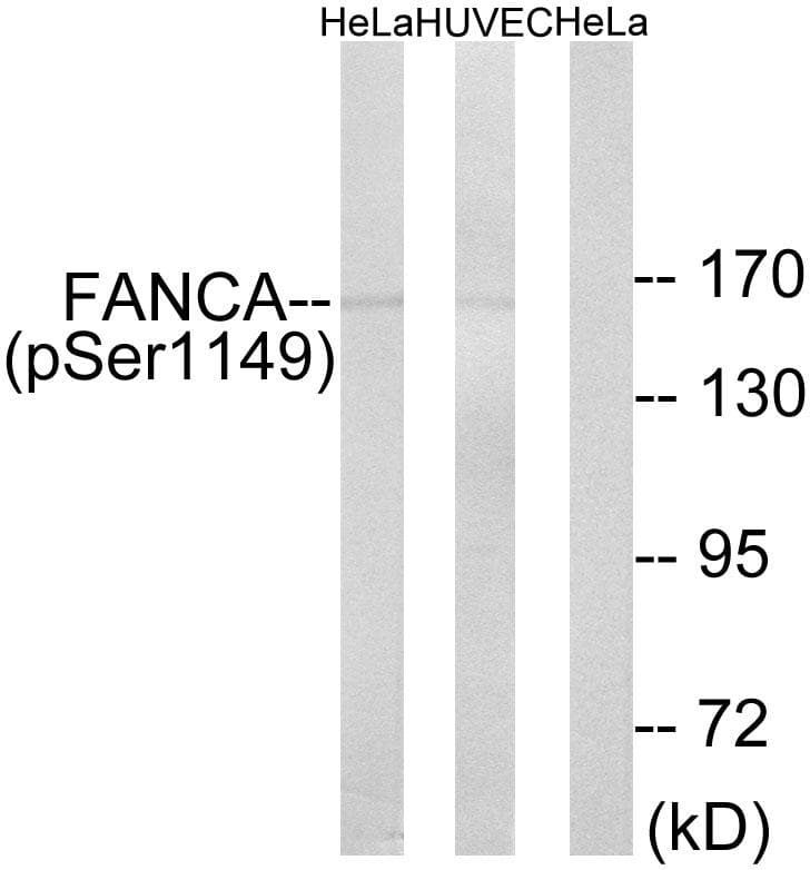 FANCA Antibody (phospho-Ser1149)