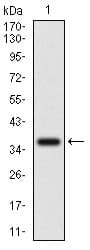 IL3RA / CD123 Antibody (aa200-305, clone 8E11C5)