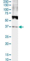 FPR2 / FPRL1 Antibody (clone 2D8)