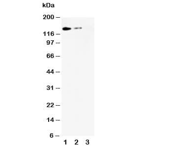 SELL / L-Selectin / CD62L Antibody (aa125-141)