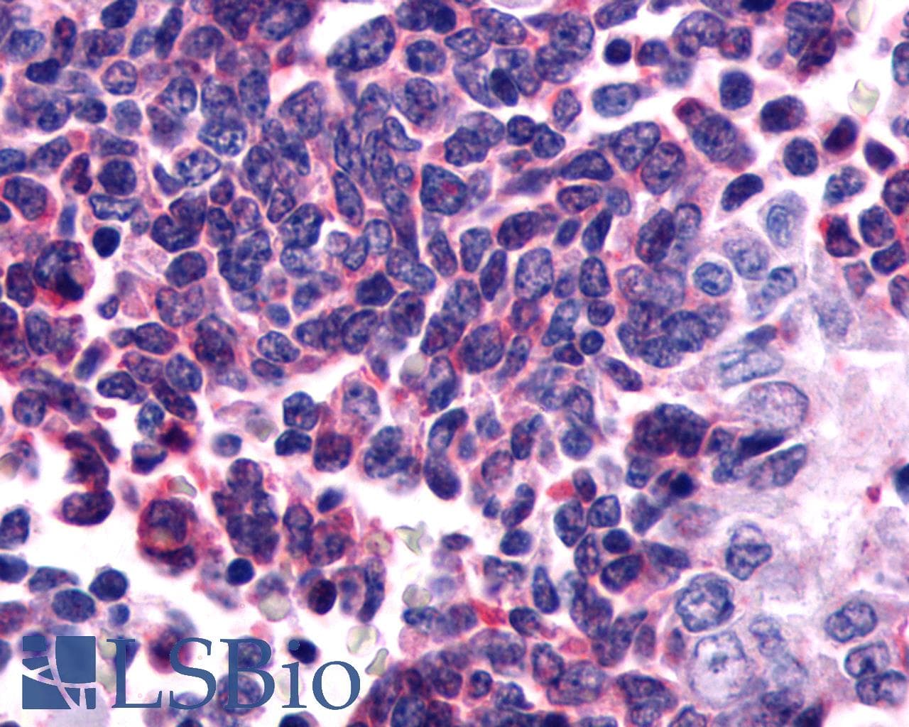 PathPlus™ GPR162 Antibody (Extracellular Domain)