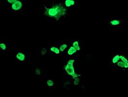 MEF2C Antibody (clone OTI1B6)