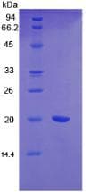 Mouse VWF / Von Willebrand Factor Protein (Recombinant His, N-Terminal)