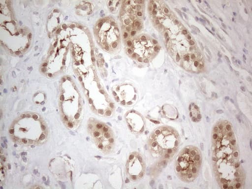TNFSF5IP1 / CLAST3 Antibody (clone OTI1E8)