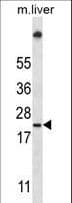 UBE2W Antibody (aa105-133)