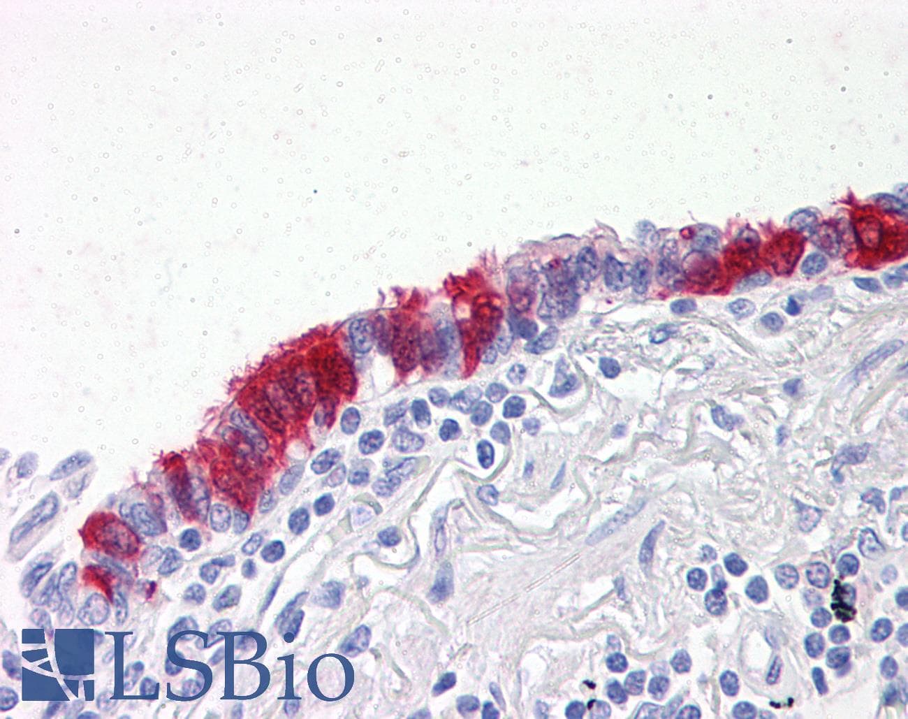 IHC-plus™ ARVCF Antibody (clone 5D2)