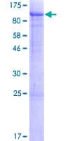 Human VASN / Vasorin Protein (Recombinant GST)