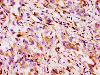 ABCB1 / MDR1 / P Glycoprotein Antibody