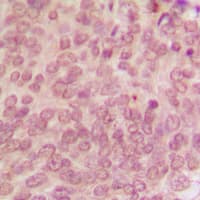 TP53 / p53 Antibody (phospho-Ser315)
