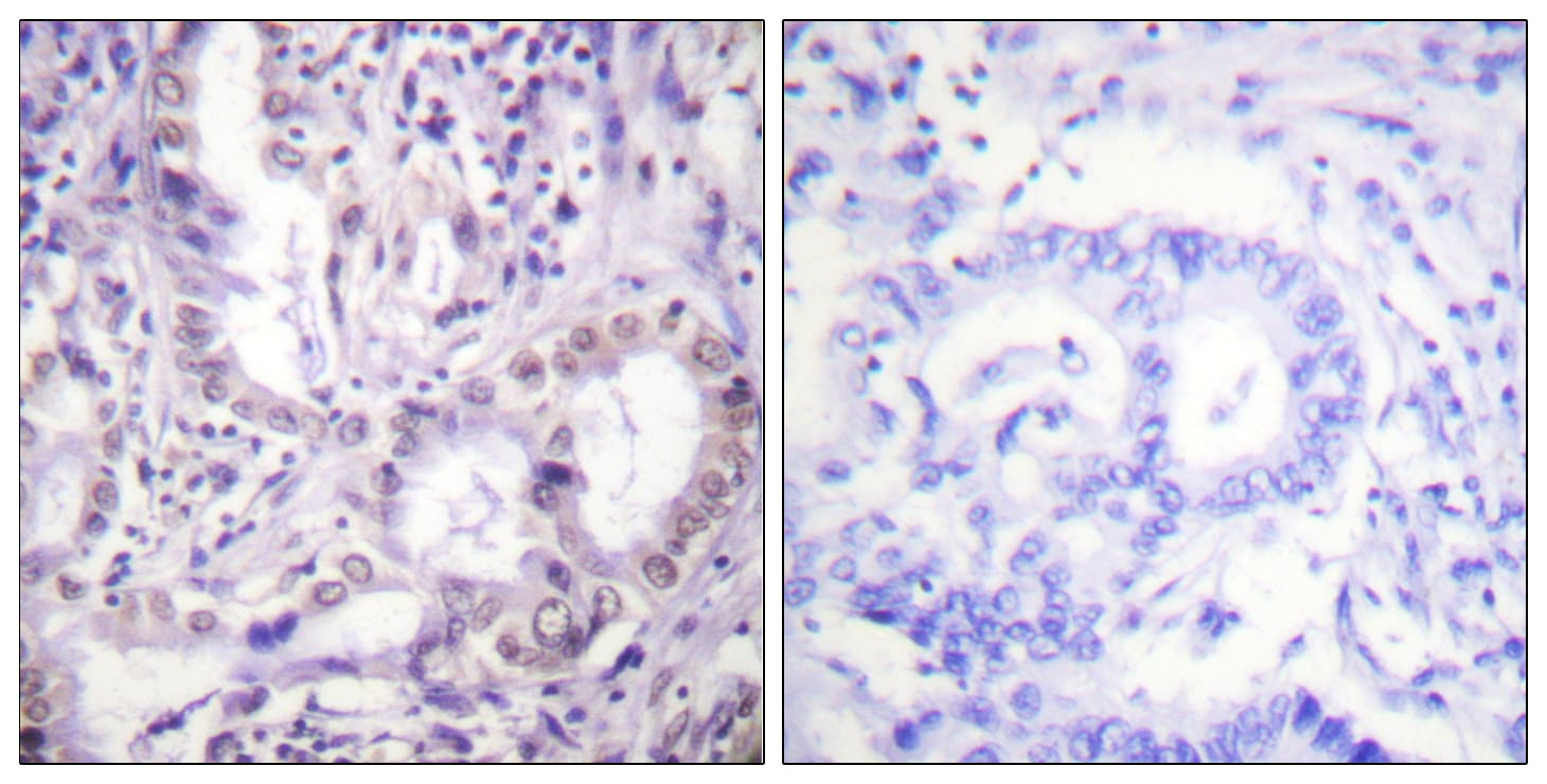 Acetyl-Lysine Antibody