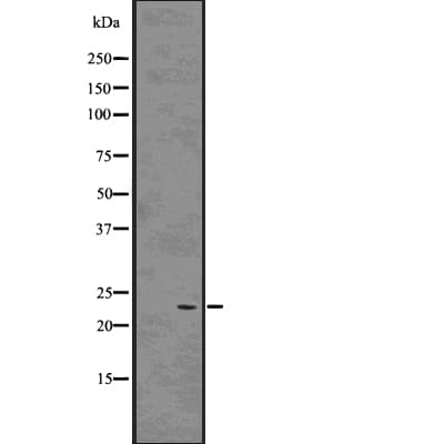RAB9A / RAB9 Antibody