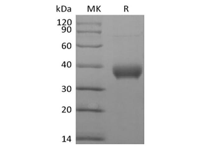 Human BTN1A1 Protein (Recombinant AVI-6His, C-terminus)