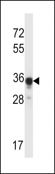 ABHD4 Antibody (aa98-127)