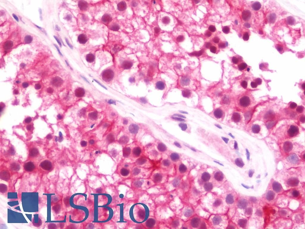 IHC-plus™ Polyclonal Rabbit anti-Human PVRL2 / CD112 Antibody (aa270-499, IHC, WB)