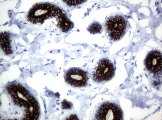 KRT18 / CK18 / Cytokeratin 18 Antibody (aa69-372, clone UMAB50)