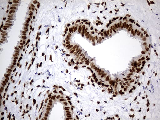 Monoclonal Mouse anti-Human HNRNPH1 / hnRNP H Antibody (clone OTI1H3, IHC, WB)
