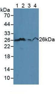 BCL2 / Bcl-2 Antibody (aa2-208)